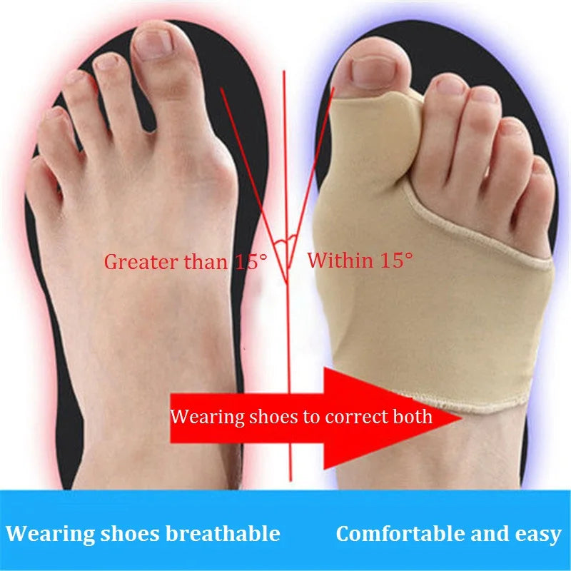 Bunion Corrector Gel Sleeve – Hallux Valgus Toe Straightener & Protector (1 Pair)