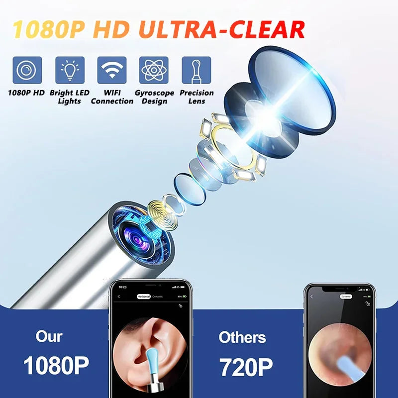 Visual Ear Wax Cleaner with Camera – WiFi Otoscope & Smart Ear Cleaning Kit